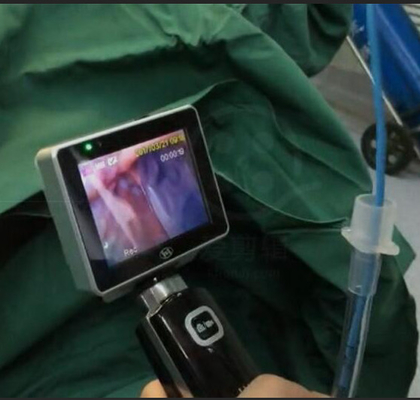 Laringoscopio video de la intubación no reutilizable de ICU el ccsme con la resolución de 1280 x 720 cámaras