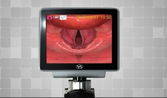 Laringoscopio video 1320 de la fibra óptica plástica del metal de HYHJ con las cuchillas disponibles
