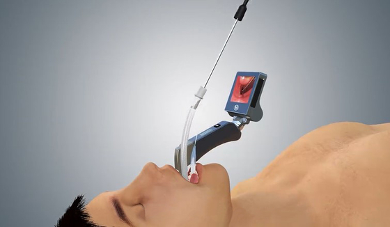 Laringoscopio de 5 Mac Miller Blades Medical Digital Video con la caña ergonómica de la mano
