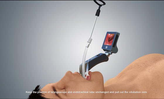 Videolaringoscopio USB portátil HD Adulto Pediátrico Haiye Medical