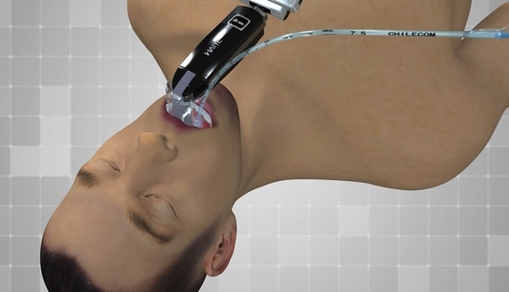 El FDA certificó el laringoscopio video de la salida portátil del endoscopio USB de 3,0 exhibiciones
