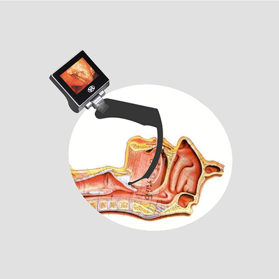 Videolaringoscopio de mano para intubación CMOS con visualización de glotis hiperangulada de 70 grados