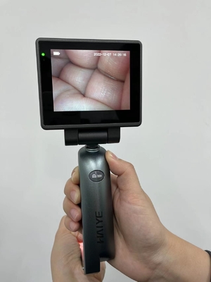 3,0 laringoscopio video médico de la exhibición de la pulgada HD - laringoscopio video de la intubación