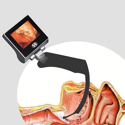 Laringoscopio video de la anestesia reutilizable del LCD de 360 grados 2 millones de pixeles