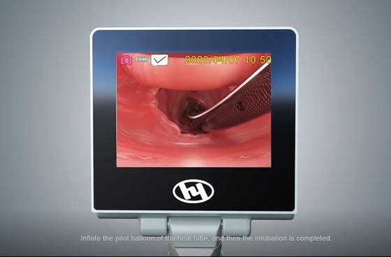 Laringoscopio video de Digitaces del metal del Médico-grado de HYHJ-KC de la niebla del sistema anti material de la cámara