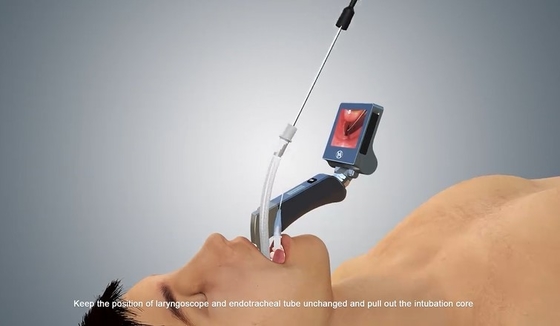 Equipo video médico microbiano anti del laringoscopio para la pediatría 1280 x pixel 720